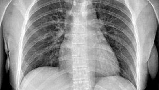 Data Breach di dati sanitari, 5 milioni di esami esposti. Indaga il Garante